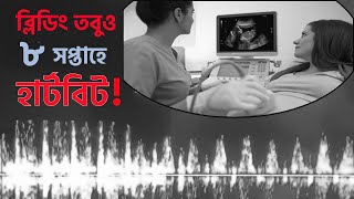 ব্লিডিং হয়ার পরে ও বাচ্চার হার্টবিট এসেছে।Bleeding in 8 weeks [upl. by Stauffer]