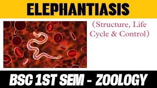 Elephantiasis Structure  life Cycle  Control Notes in Hindi  BSC 1 SEMESTER ZOOLOGY [upl. by Hazem186]