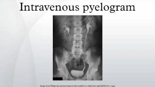 Intravenous pyelogram [upl. by Llirret]