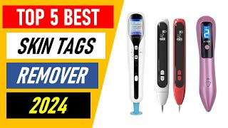 Top 5 Best Skin Tags Remover in 2024 [upl. by Enajiram205]