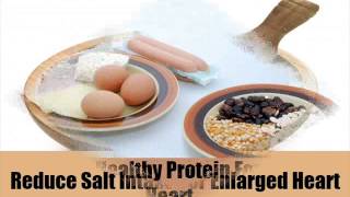 5 Important Diet For Enlarged Heart [upl. by Yeltneb708]