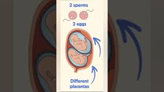 twins pregnancy baby conceive pregnancysigns viral [upl. by Ohare349]