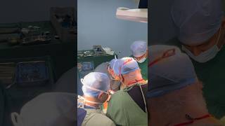 Hepatectomy I Advanced GI SURGERY I Liver Team I Surat I India [upl. by Aural]