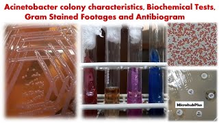 Acinetobacter colony characteristics Biochemical Tests Gram Stained Footages and Antibiogram [upl. by Powe]