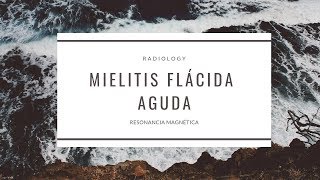 Mielitis flácida aguda [upl. by Airotciv]