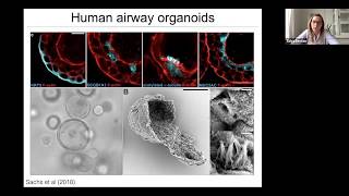 Dr Talya Dayton quotOrganoid models of neuroendocrine cell growth and tumorigenesisquot [upl. by Amarillis]