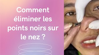 Comment enlever les points noirs avec un tirecomédon [upl. by Dottie]