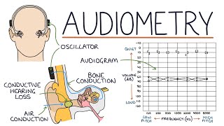 Understanding Audiometry and Audiograms [upl. by Schwenk399]