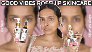 I tried GOOD VIBES Rosehip Skincare Products for 25 days amp heres the REVIEW [upl. by Zuckerman247]