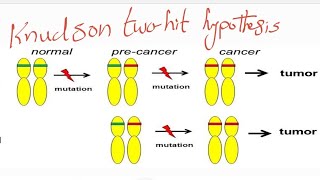 knudson two hit hypothesis compound heterozygote and consanguinty [upl. by Eey]