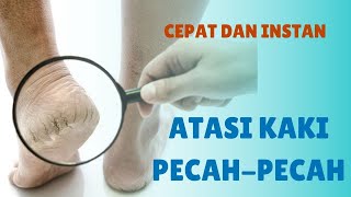 Telapak Kaki PecahPecah Cara Alami Ini Bisa Jadi Solusi [upl. by Ahsinel]