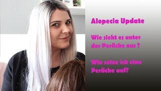 Alopecia Update  wie sieht es unter der Perücke aus  Perücke aufsetzen [upl. by Corson460]