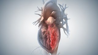 Acute Coronary Syndrome and Heart Attack [upl. by Aivizt]