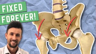 How to Permanently Fix an Anterior Pelvic Tilt [upl. by Korrie]