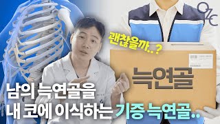 코끝 재료의 전쟁 자가 늑연골 vs 기증 늑연골 각각의 장단점 총정리 코성형 전문 앤플러스 [upl. by Arikal665]