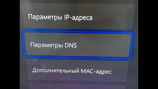 DNS в xBox  Увеличиваем СКОРОСТЬ ИНТЕРНЕТА [upl. by Norrat]