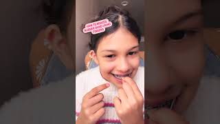 How to braces triangle rubber band using Fingers [upl. by Arratoon]