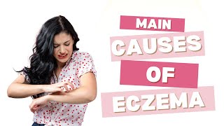 Top Causes of Eczema What Triggers This Common Skin Condition [upl. by Oos141]