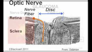 Eye Works 2 Image Retina Optic Nerve and Brain [upl. by Wan]