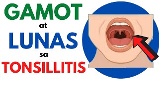 LUNAS at GAMOT sa TONSILLITIS  Masakit LUMUNOK Namamagang TONSILS sa Bata at Matanda [upl. by Fidelio]