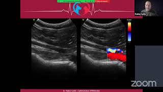 Webinar Ecocardiografia Doppler Veterinaria [upl. by Kauffman377]