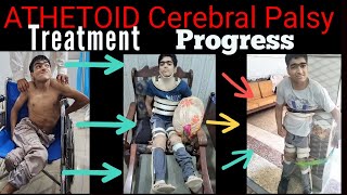 Athetoid Cerebral Palsy During treatment progress  Adult Cerebral Palsy Patient [upl. by Zelig219]