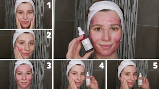 How to Apply The Ordinary 30 AHA  2 BHA Peeling Solution with Niacinamide and Alpha Arbutin [upl. by Eyatnod]