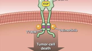 Osimertinib in Advanced Non–SmallCell Lung Cancer [upl. by Ailuj]