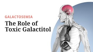 Galactosemia Pathogenesis The Role of Toxic Galactitol [upl. by Oludoet]