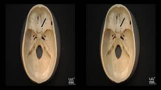 Anatomie 3D de létage antérieur de la base du crâne [upl. by Trebled]