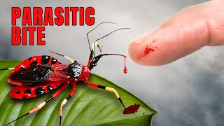 ASSASSIN BUG puts me in the Hospital [upl. by Naol]