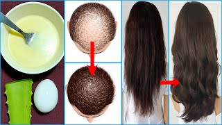 Aloe Vera And Egg Hair Mask Fast Hair Growth Stop Hair Loss Hair Growth Home Remedy [upl. by Oinotnanauj]