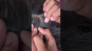 Lice picking hair headlice haircare headliceremoval louse headlicetreatment short1 [upl. by Atteinotna]