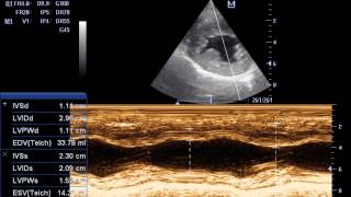 ECOCARDIOGRAFIA DOPPLER ESTENOSIS SUBAORTICA EN CANINOS IVAN ALVAREZ [upl. by Nodearb]