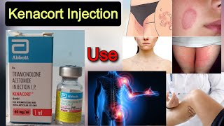 Kenacort 40 mg injection का उपयोग  Triamcinolone acetonide injection दाद खाजखुजलीआर्थराइटिस [upl. by Masry]