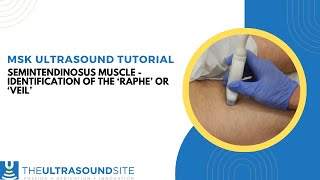 Ultrasound identification of the Semitendinosus muscle Raphe or Veil [upl. by Oiralednac914]