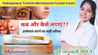 Hydroquinone tretinoin mometasone furoate cream  Melamet Cream Ki Jankari  Drx Pranjali Satpute [upl. by Zumstein315]