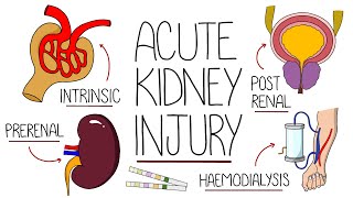 Understanding Acute Kidney Injury AKI Made Easy [upl. by Enidualc]