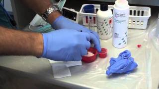 Denture Soft Reline Part 1 [upl. by Wandy]