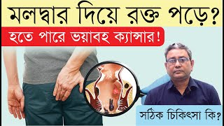 মলদ্বার দিয়ে রক্ত পড়ে হতে পারে ভয়াবহ ক্যান্সার  পায়খানার রাস্তা দিয়ে রক্ত পড়া  Medinet [upl. by Anaher]