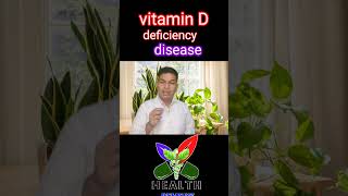 vitamin d deficiency  youtube yt health remedy  health remedy [upl. by Llertnom]