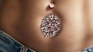 ASMR Infected Worm Insect On Part  ASMR Deep Surgery 2D Treatment Animation [upl. by Devine834]