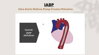 Cardiac ssist device IABP [upl. by Schwarz]