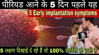 5 Early Implantation symptoms first day of implantation symptoms early pregnancy tips [upl. by Gnilsia]