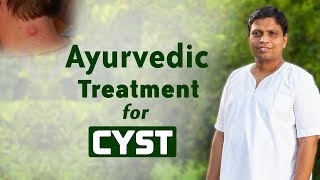 Ayurvedic Treatment for Cyst  Acharya Balkrishna [upl. by Eilloh560]