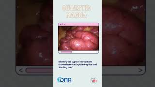 Intestinal peristalsis  OSPE amp OSCE  MBBS  NEXT  PLAB  USMLE [upl. by Tita]