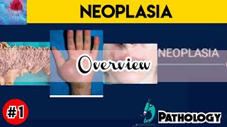 Neoplasia Pathology  introduction [upl. by Okeim181]