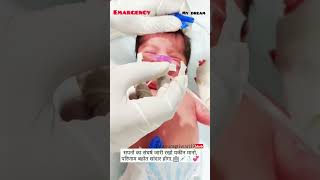 How to use ryles tubes Hospital duty viralvideo mbbsdairies viralreels video shortsfeed [upl. by Allebasi]