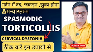 गर्दन में दर्द जकड़न झुकाव Spasmodic Torticollis को ठीक करें इन उपायों से।beinghealthy11 [upl. by Swithbert416]