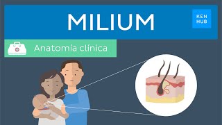 Milium Definición presentación clínica tratamiento y manejo  Kenhub [upl. by Wise]